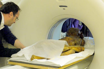 The pre-dynastic mummy from Gebelein being fed into the CAT Scanner at Cromwell Hospital.